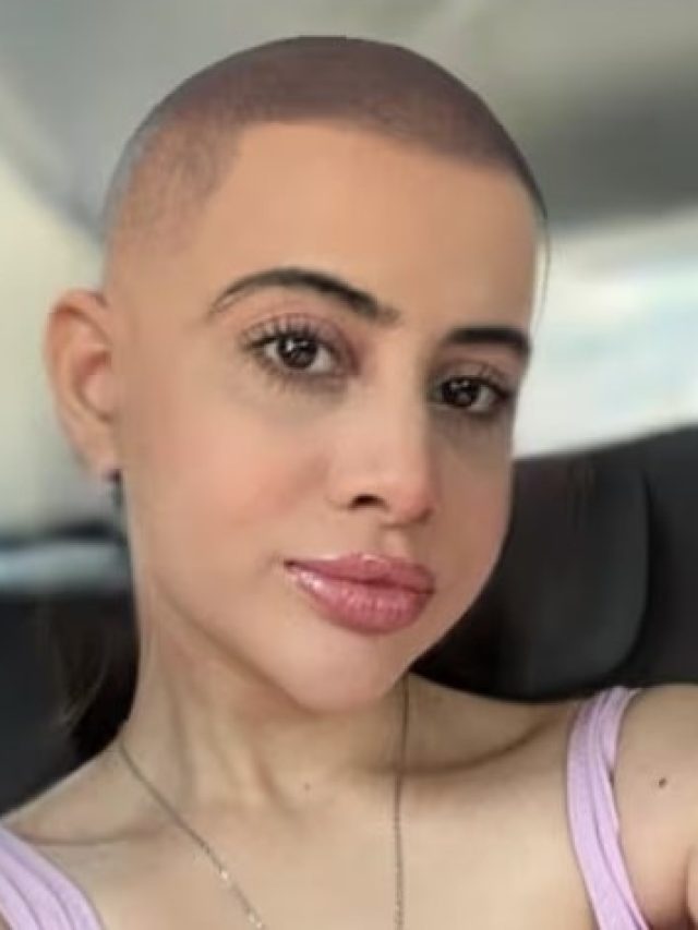 টাক মাথাতেও গজাবে নতুন চুল, বদলে ফেলুন চিরুনি