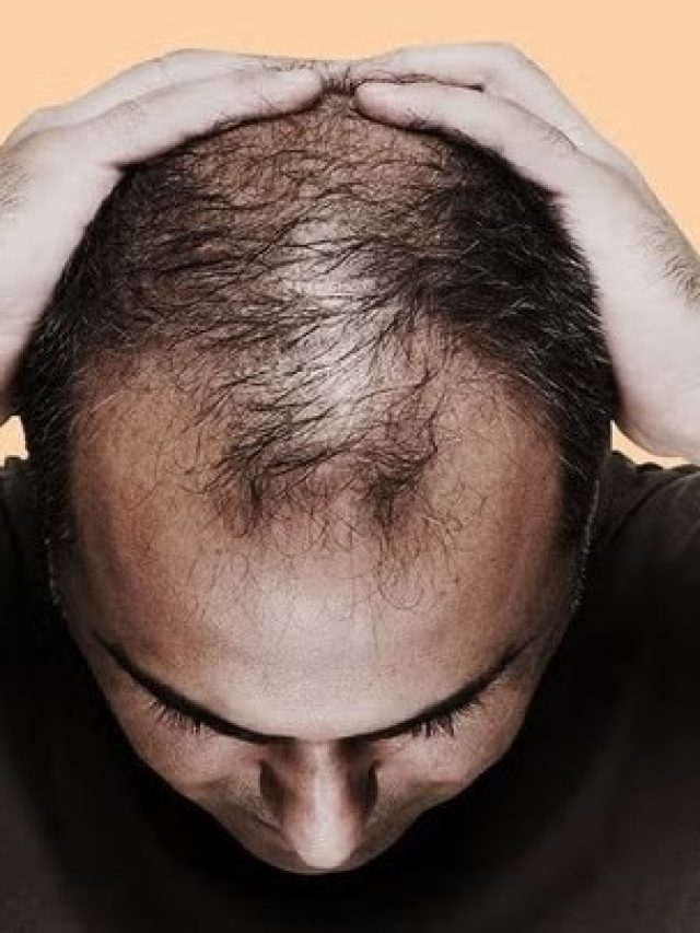 টেকো মাথায় ৭ দিনেই গজাবে নতুন চুল, সকালে উঠে খেয়ে ফেলুন এই কালো জিনিস