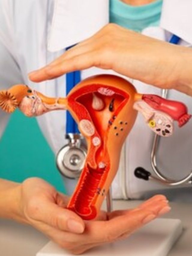 ওষুধ-অপারেশন ছাড়াই কমবে জরায়ুর ফাইব্রয়েড টিউমার,খান এই ৫ খাবার