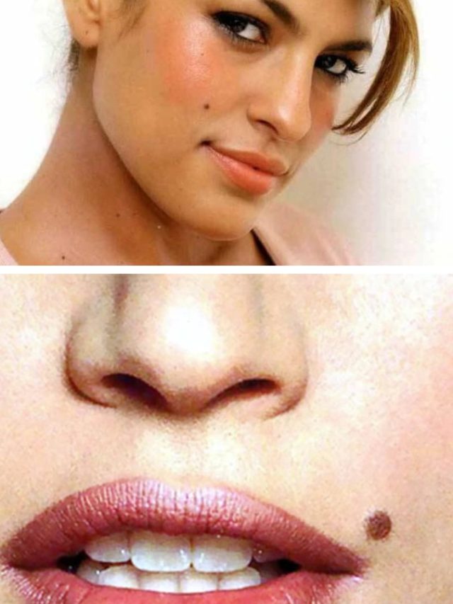 ডান গাল না বাঁ গাল, কোথায় তিল থাকলে আপনি ভাগ্যবান?