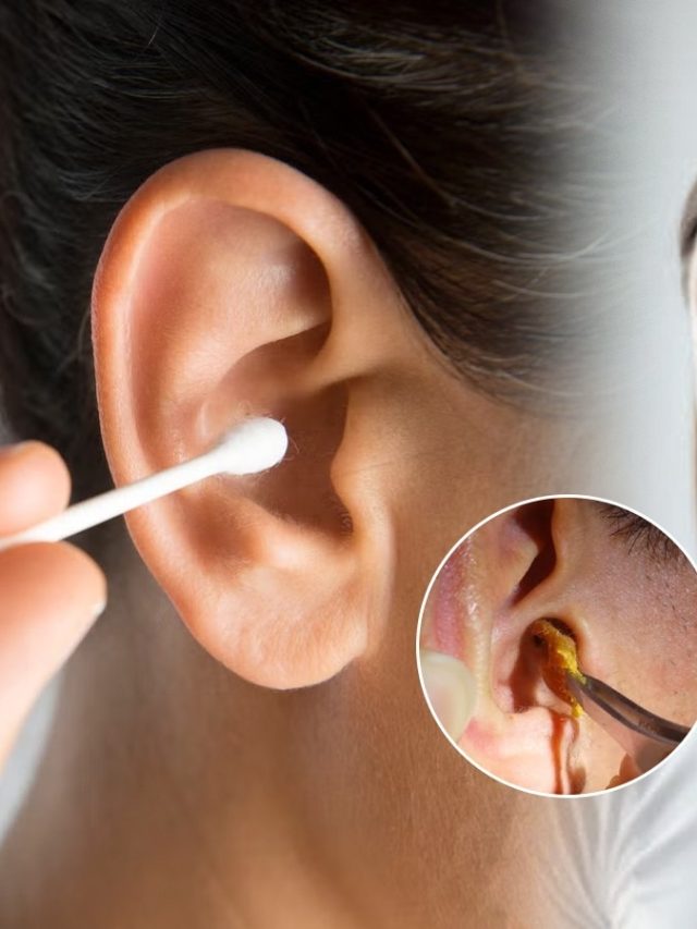 কানের খোল বের করতে বাডসের ব্যবহার, বিশেষজ্ঞরা বলছেন...