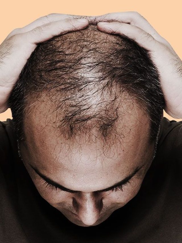 টাকলা মাথায় নতুন চুলের বাগান ৭দিনে, নারকেল তেলে ফেলুন এই সস্তার ফুল