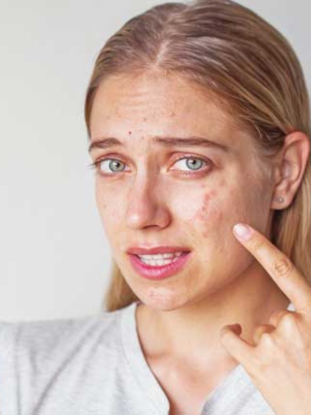 মুখে অ্যালার্জির সমস্যায় জেরবার? এই  ঘরোয়া টোটকাতেই সব সারবে