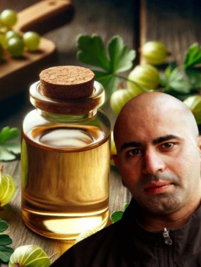 এক মাসে টাকে চুল গজাবে, বাড়িতেই বানিয়ে নিন আমলা তেল