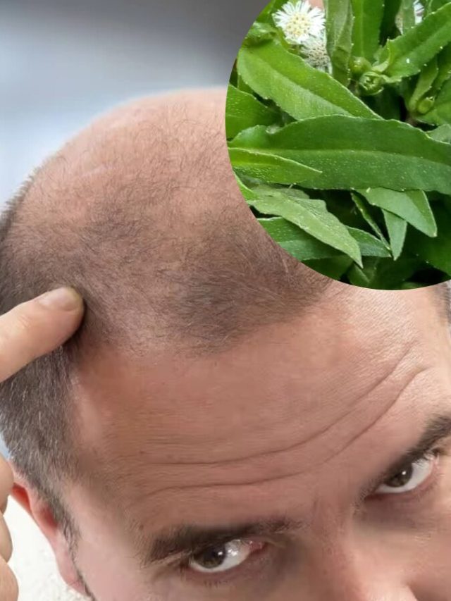 টাক মাথায় হবে কুচকুচে ঘন চুল, বাংলার এই পাতাতেই হবে কাজ