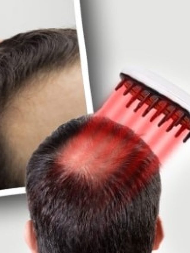 টাক মাথা চুলে ভরে যাবে দ্রুত, এই চিরুনি দিয়ে আঁচড়ালেই