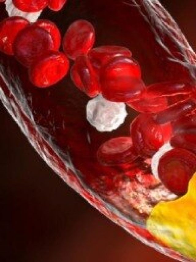 ভাত খাওয়ার আগে কামড়ে খান এই সবজি, ভ্যানিশ হবে কোলেস্টেরল