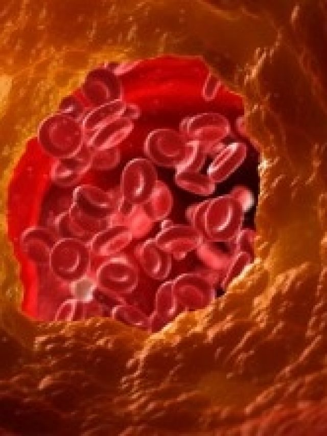 রোজ মুখ ফেলুন এই মশলা, আর কোলেস্টেরল বাড়বে না