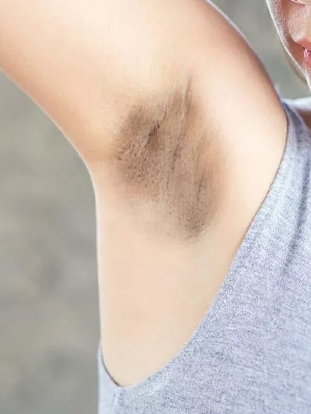 বগলের কালো দাগ তুলবেন কী করে? পার্লার দিদি জানালেন 'সিক্রেট'