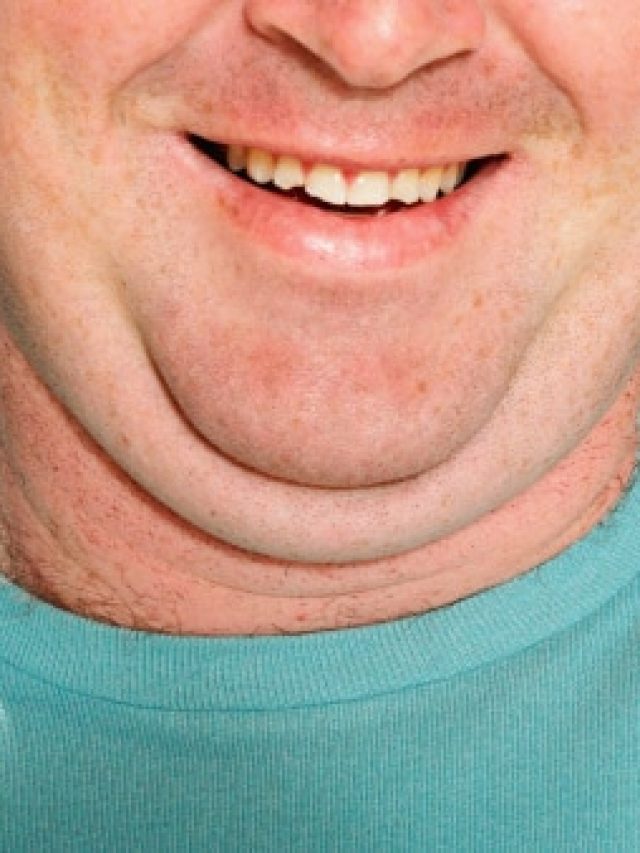 ডাবল চিনের কমানোর টেকনিক  জানুন, আর বয়স বেশি লাগবে না