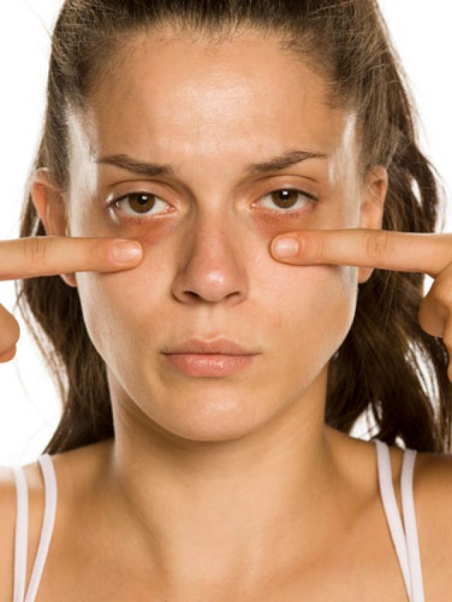 চোখের নীচের কালো দাগ দূর হবে চিরতরে, থাকল ৬ জবরদস্ত টোটকা