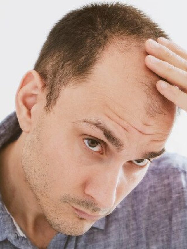 মাথার সামনের দিকে চুল পড়ে টাক, সর্ষের তেলে এই পাতা মিশিয়ে মাখলেই চুলের বাগান