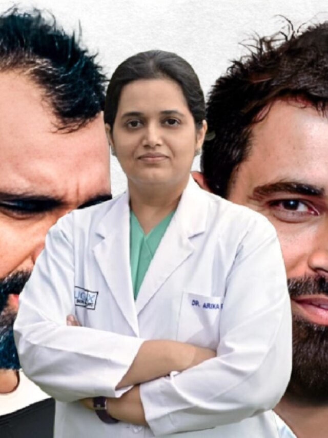 কম বয়সে টাক? টিপস দিলেন শামির হেয়ার ট্রান্সপ্ল্যান্ট করা সেই ডাক্তার