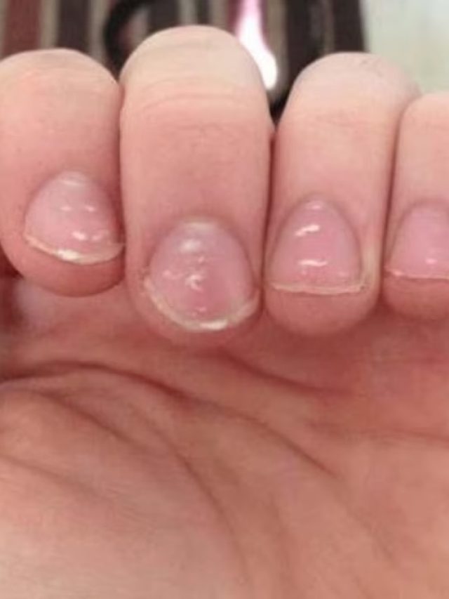 নখে এই দাগ থাকলেই মালামাল, দু'হাত ভরে টাকা আসবে