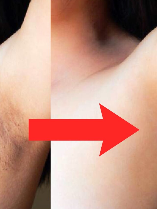 বিন্দাস পরুন স্লিভলেস, রান্নাঘরের এই জিনিসে তুলুন বগলের কালো দাগ