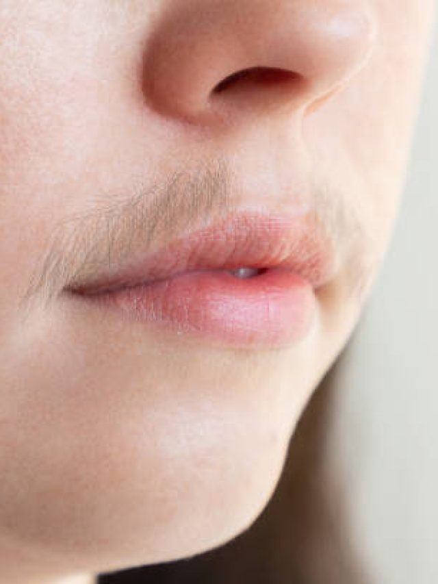 মুখের অবাঞ্ছিত লোমে নষ্ট সৌন্দর্য? পার্লার দিদির টিপসে দূরে হবে নিমেষে