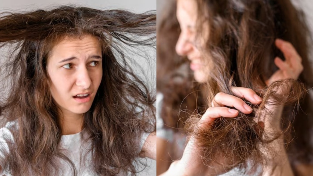 सर्दियों में सूखे-उलझे बालों से पाएं निजात! डाइट में शामिल करें एक्सपर्ट्स की बताई 5 चीजें