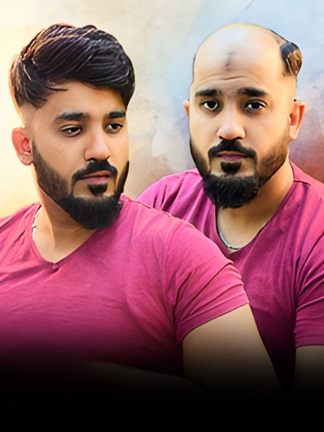 जवानी में ही बाल झड़ने के 5 सबसे बड़े कारण, बालों के डॉक्टर ने बताए