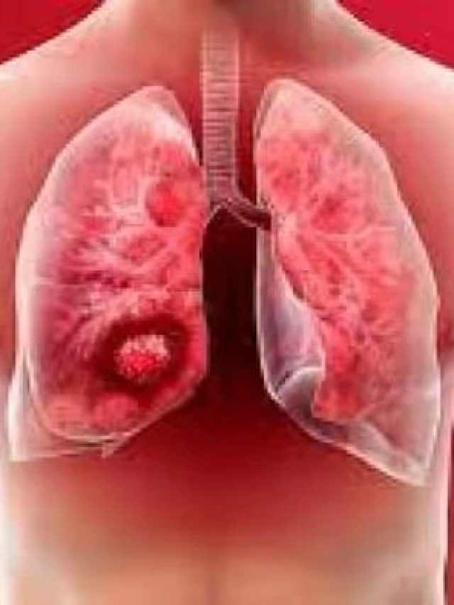 ২ টাকার মশলায় কামাল, ফুসফুস হবে জন্মের সময়ের মতো তাজা, সুস্থ