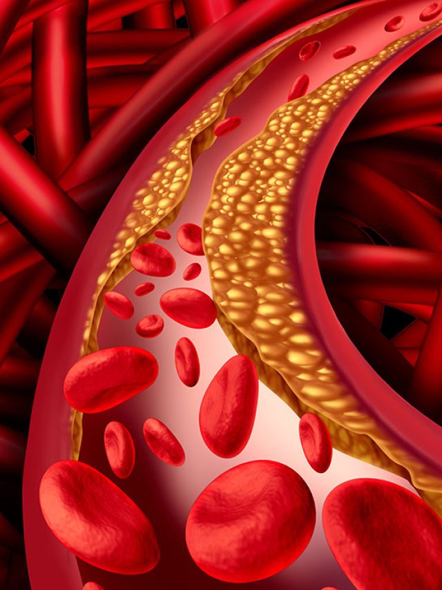 সকালের পায়খানা দিয়ে বেরোবে কোলেস্টেরল, গরম জলে গুলে খান এই জিনিস