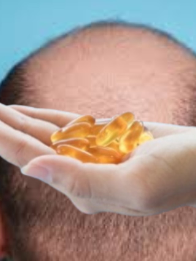 ন্যাড়া মাথাতেও গজাবে ঘন চুল, নারকেল তেলে মেশান এই ক্যাপসুল