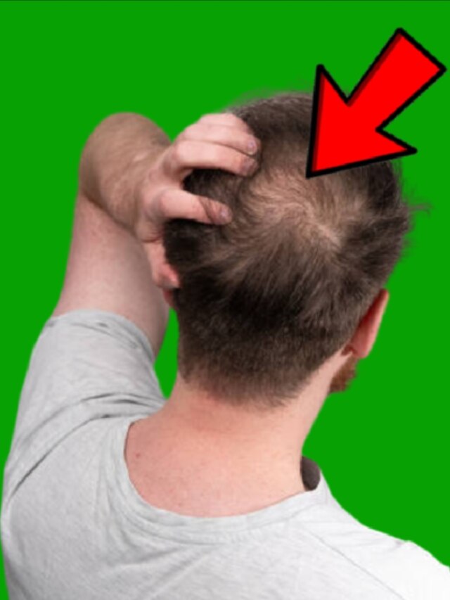 কমবয়সেই মাথা হচ্ছে ফাঁকা? এই সবজির রসেই গজাবে নতুন চুল