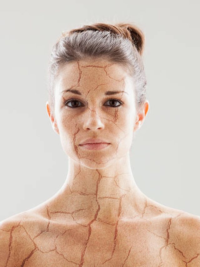 ढीली और लटक रही त्वचा में जान फूंक देगीं ये चीजें, स्किन हो जाएगी मक्खन की तरह सॉफ्ट