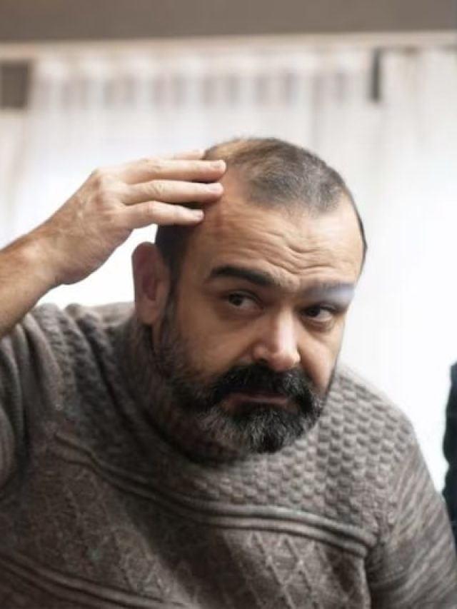 किस विटामिन की कमी से बाल झड़ते हैं? जानें और ऐसे करें कमी को पूरा