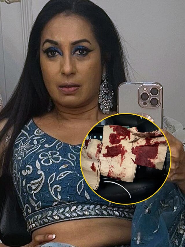 कश्मीरा का हुआ एक्सीडेंट, खून से लथपथ फोटो की शेयर, डरे पति कृष्णा अभिषेक