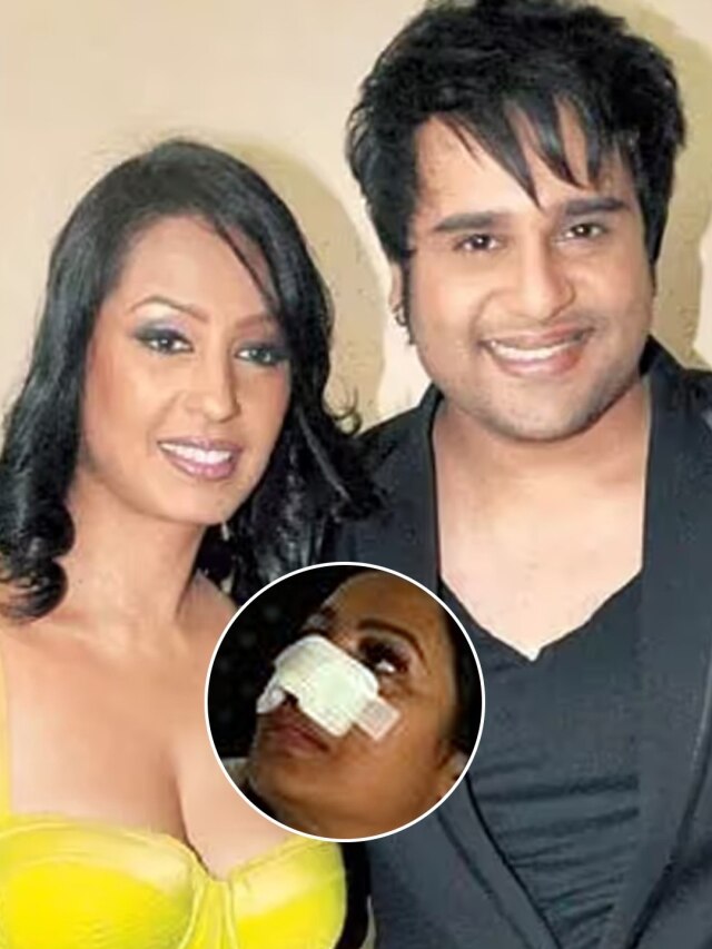 एक्सीडेंट से कश्मीरा के चेहरे पर आए गहरे निशान, बोलीं- कृष्णा कहेगा तुमने नाक काट दी