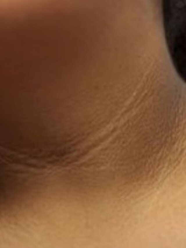 गर्दन की काली धारियां और बैली फैट हो जाएगा छूमंतर, डायटीशियन ने बताया क्या खाएं