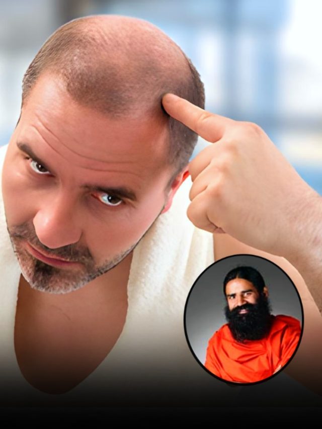गंजे सिर पर बाल उगाने के लिए देसी नुस्खे, स्वामी रामदेव ने बताए