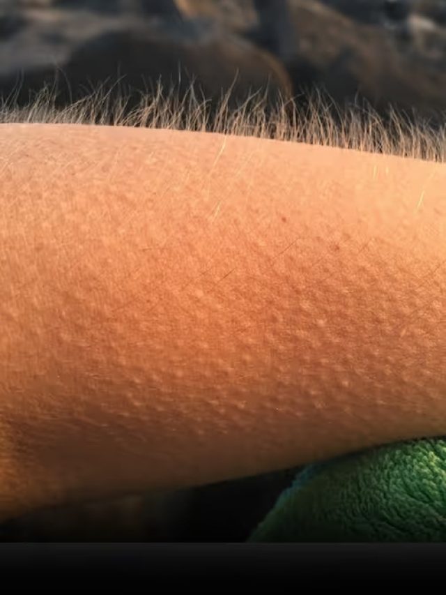 গায়ের লোম কেন খাড়া হয় জানেন? অনেকেরই অজানা