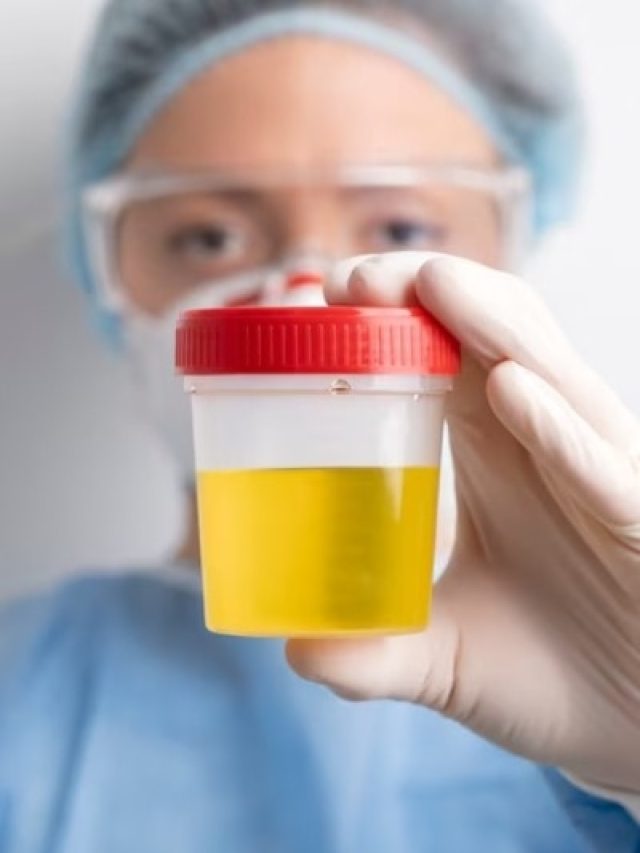 किस विटामिन की अधिकता से पीला होता है पेशाब? जानिए