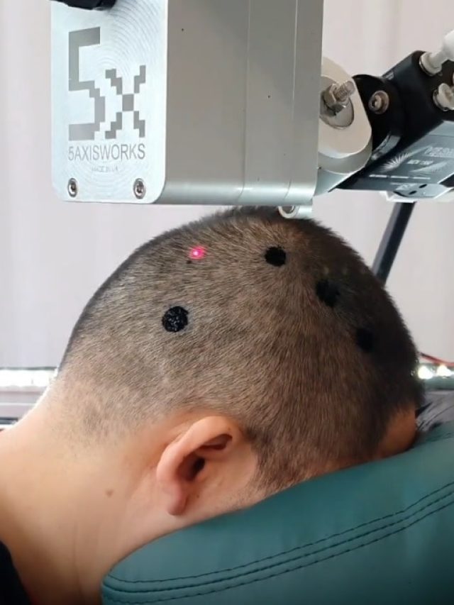 सिर पर बना इलेक्ट्रॉनिक टैटू मापेगा दिमाग की एक्टिविटी! जानें कैसे करेगा काम