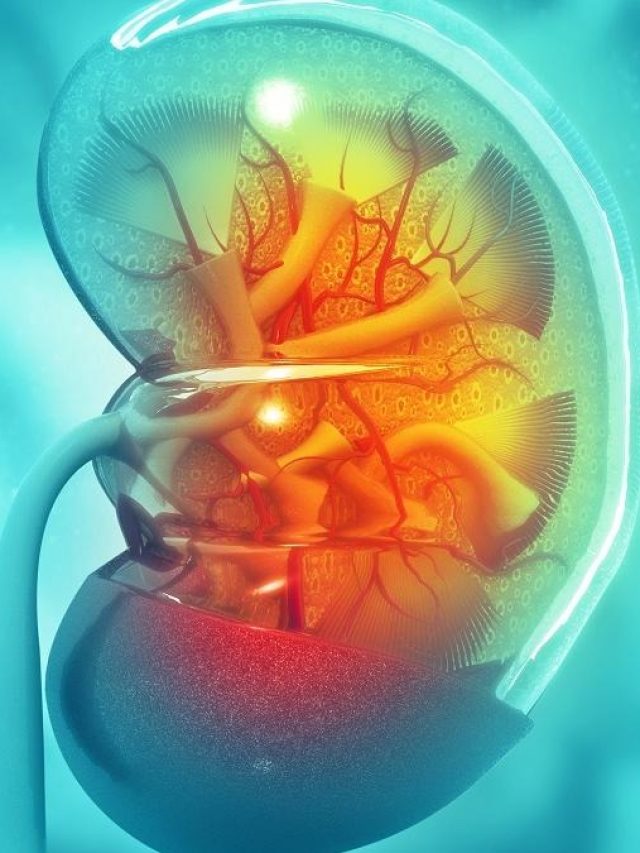 এই ৫ খাবার বিষ, খেলে কিডনিতে পাথর জমবেই