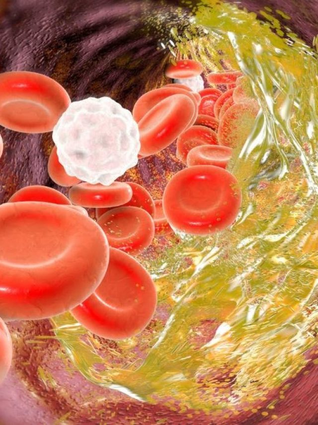 কামড়ে খান এই সবজি, তাতেই কোলেস্টেরল ভ্যানিশ হয়ে যাবে