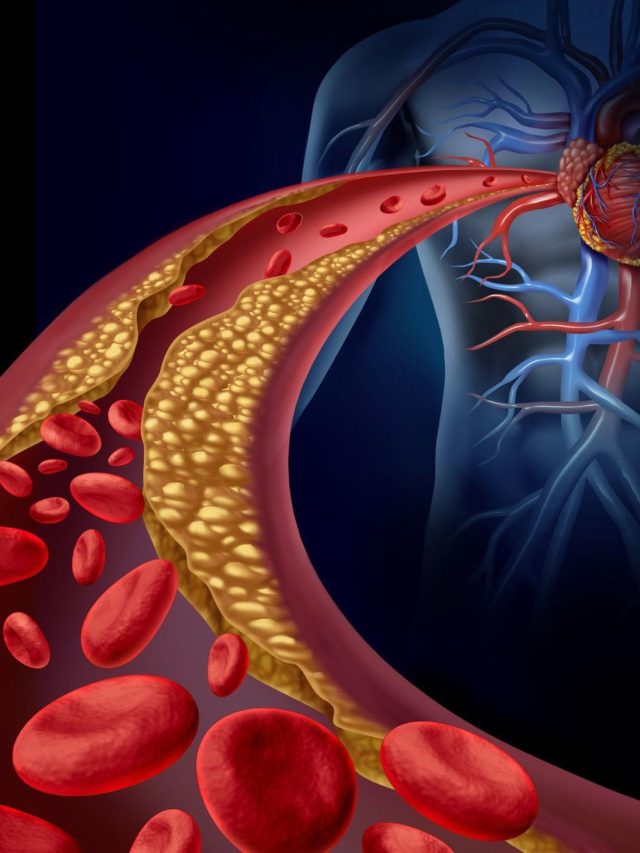 এই ৫ দেশি খাবারেই ভয়ঙ্কর কোলেস্টেরল কাবু, শিরার ময়লা হবে সাফ