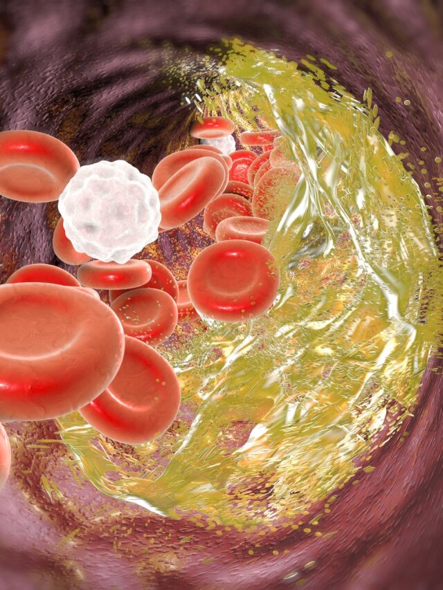 नसों में चिपका गंदा कोलेस्ट्रॉल निकल जाएगा बाहर, आचार्य बालकृष्ण ने बताया खास तरीका