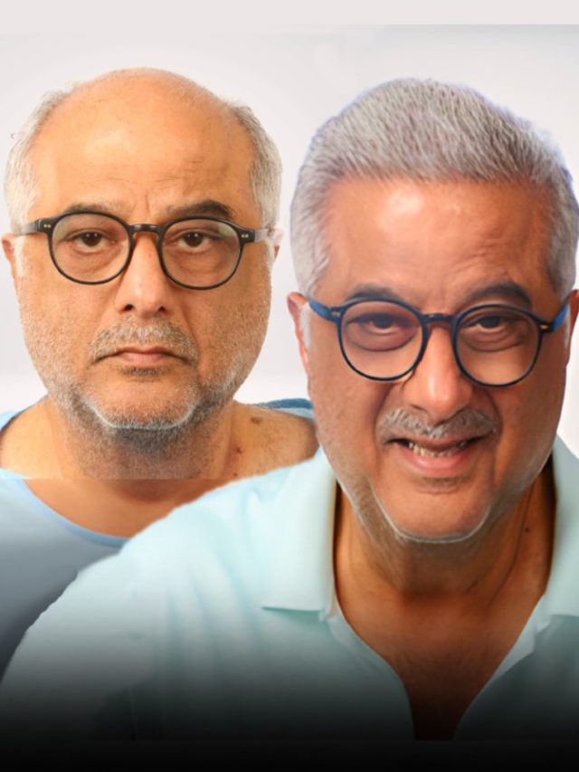 बोनी कपूर के आ गए बाल, 6 महीने का लगा समय...जानें कैसे हुआ ये कमाल