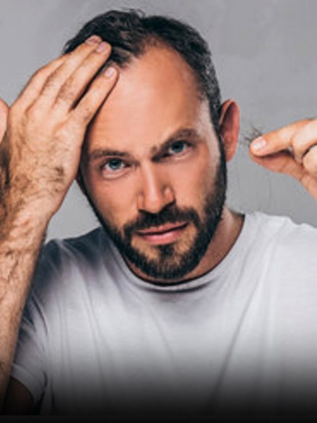 अगर दिखें ये संकेत तो समझ जाएं हो रहा हेयरफॉल...बालों के डॉक्टर ने बताया