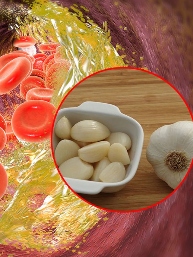 কোলেস্টেরলের 'নাম- নিশান' থাকবে না! শুধু এই সময় খান ৩ কোয়া রসুন