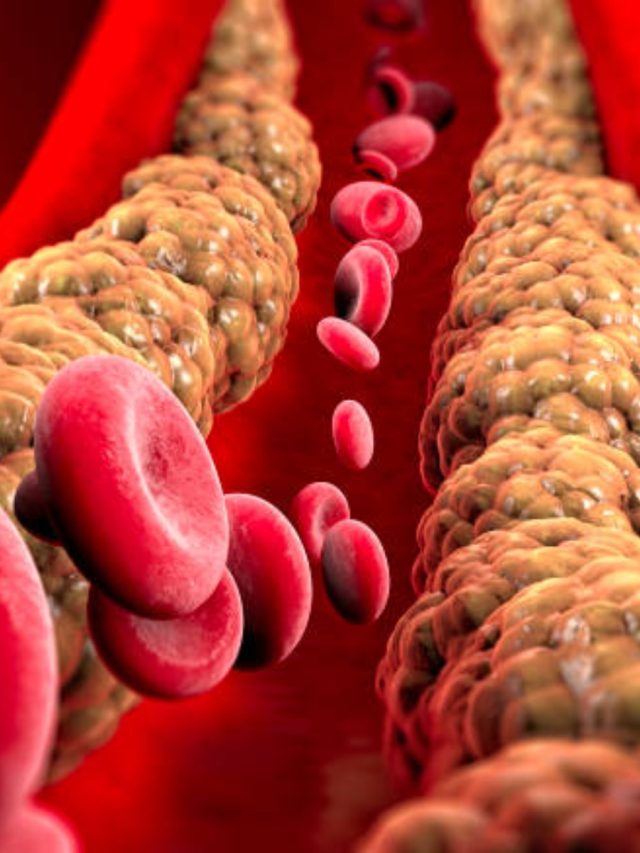 ভয়ঙ্কর কোলেস্টেরলের যম এই ৫ খাবার, শরীর থেকে নিংড়ে  বার করে