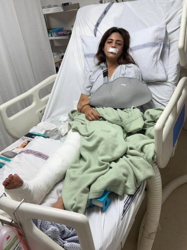 टूटी हड्डियां-होंठों पर पट्टी, जख्मी हाल में सलमान की 'राखी बहन', शेयर की दर्दनाक फोटो