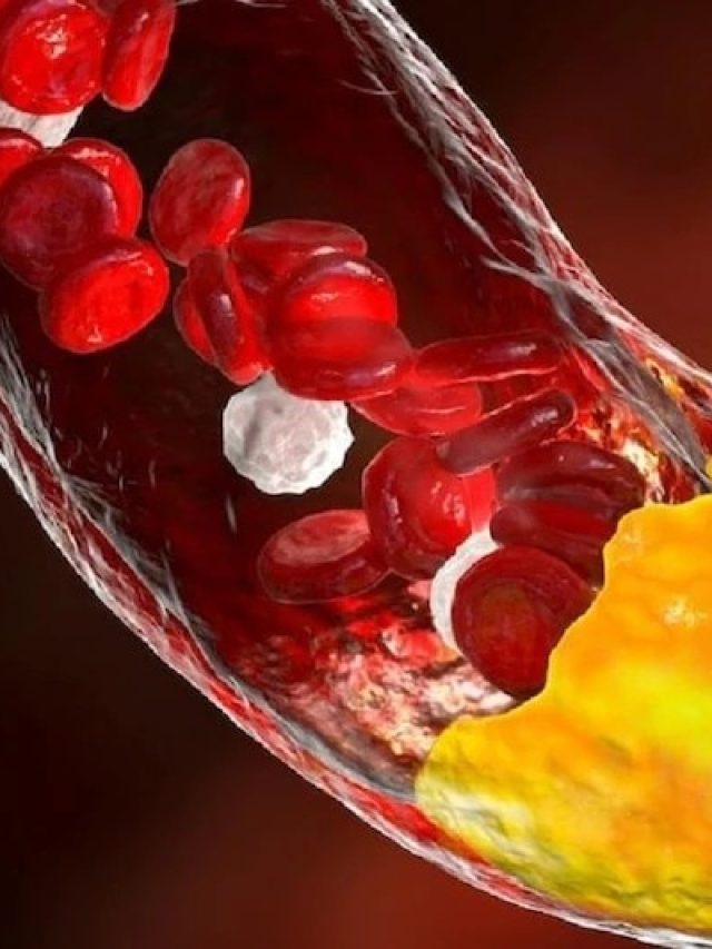 পাঁই পাঁই করে  পালাবে কোলেস্টেরল, চিবোতে থাকুন এই পাতা