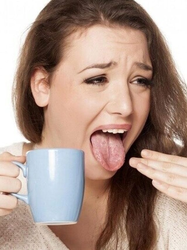 গরমে পুড়ে যাওয়া জিভে মিলবে চটজলদি আরাম, এই উপায় সঞ্জীবনী