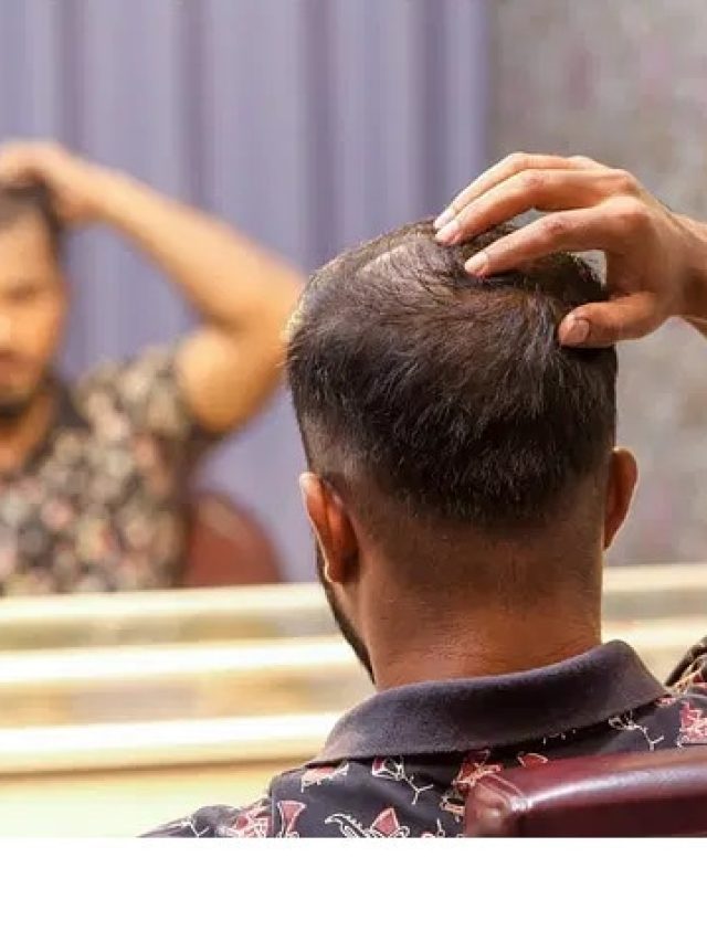৩০ বছরেই টাক পড়ছে? চুল গজানোর উপায় জানুন