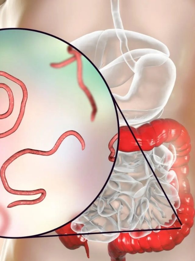 আর ভুগতে হবে না, এভাবে ওষুধ ছাড়াই কৃমির বংশ ধ্বংস করুন এবার