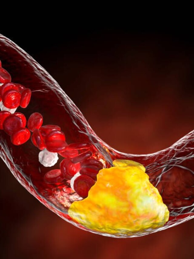 कोलेस्ट्रॉल को नसों से खींचकर बाहर ले आएंगी ये आदतें! हार्ट स्पेशलिस्ट ने बताया