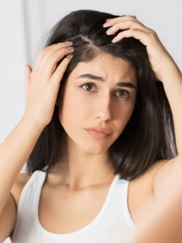 মাত্র ৭ দিনে দূর হবে খুশকি, এভাবে লাগান লেবুর রস